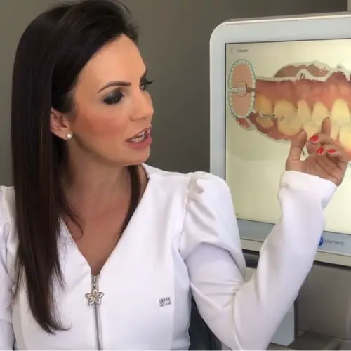 Inovação Facetas e Lentes