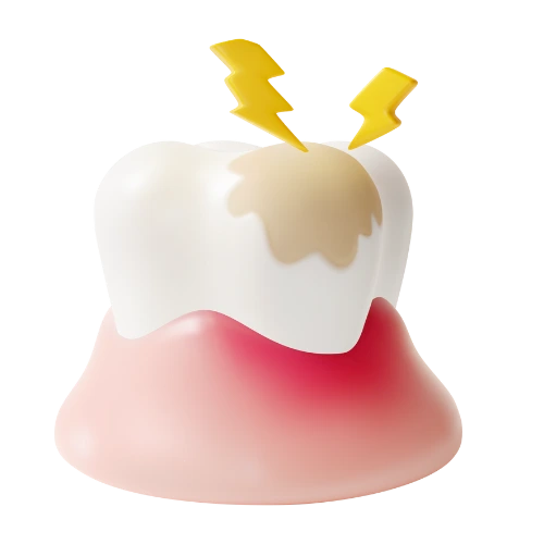 um ícone em 3d de um dente com manchas e raios amarelos sobre o dente representando a dor de dente