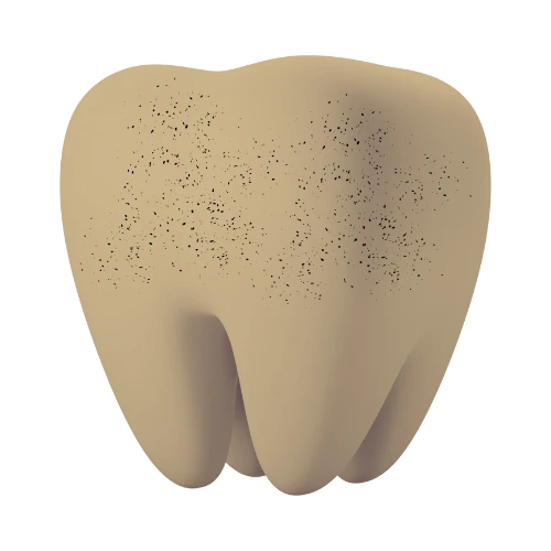 um ícone em 3d de um dente com algumas pintinhas de sujeiras como se fosse o começo de cáries